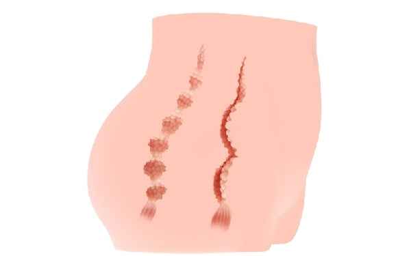 Real Hip Cherry - Flesh